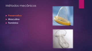 Métodos mecânicos
 Preservativo
 Masculino
 Feminino
 