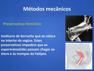 Métodos mecânicos

 Preservativo feminino

Invólucro de borracha que se coloca
no interior da vagina. Estes
preservativos impedem que os
espermatozóides possam chegar ao
útero e às trompas de Falópio.
 