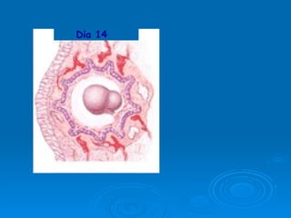 Dia 14 