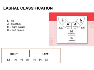 Lahsal Classification Examples Feeding plate for a newborn with Cleft Palate.pptx
