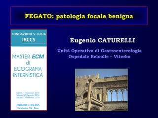 FEGATO: patologia focale benigna
Eugenio CATURELLI
Unità Operativa di Gastroenterologia
Ospedale Belcolle – Viterbo
 