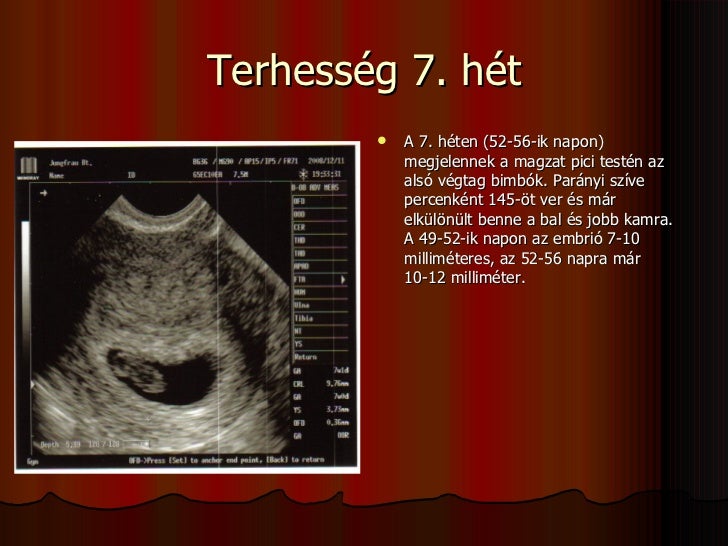 szentendrei hév menetrend 2018 2019