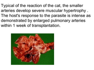 Typical of the reaction of the cat, the smaller arteries develop severe muscular hypertrophy . The host's response to the parasite is intense as demonstrated by enlarged pulmonary arteries within 1 week of transplantation. 