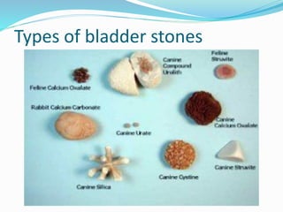 Types of bladder stones
 