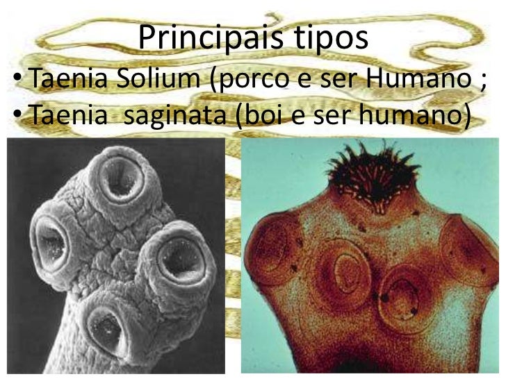 TAENIA SAGINATA E TAENIA SOLIUM DOWNLOAD TAENIA SAGINATA E TAENIA SOLIUM DOWNLOAD