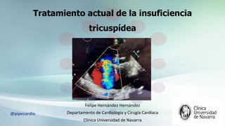 Tratamiento actual de la insuficiencia
tricuspídea
Felipe	Hernández	Hernández	
Departamento	de	Cardiología	y	Cirugía	Cardíaca	
Clínica	Universidad	de	Navarra	
@pipecardio	
 