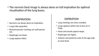 Felson’s Chapter 1. The Radiographic Examination: The Basicspptx | PPTX