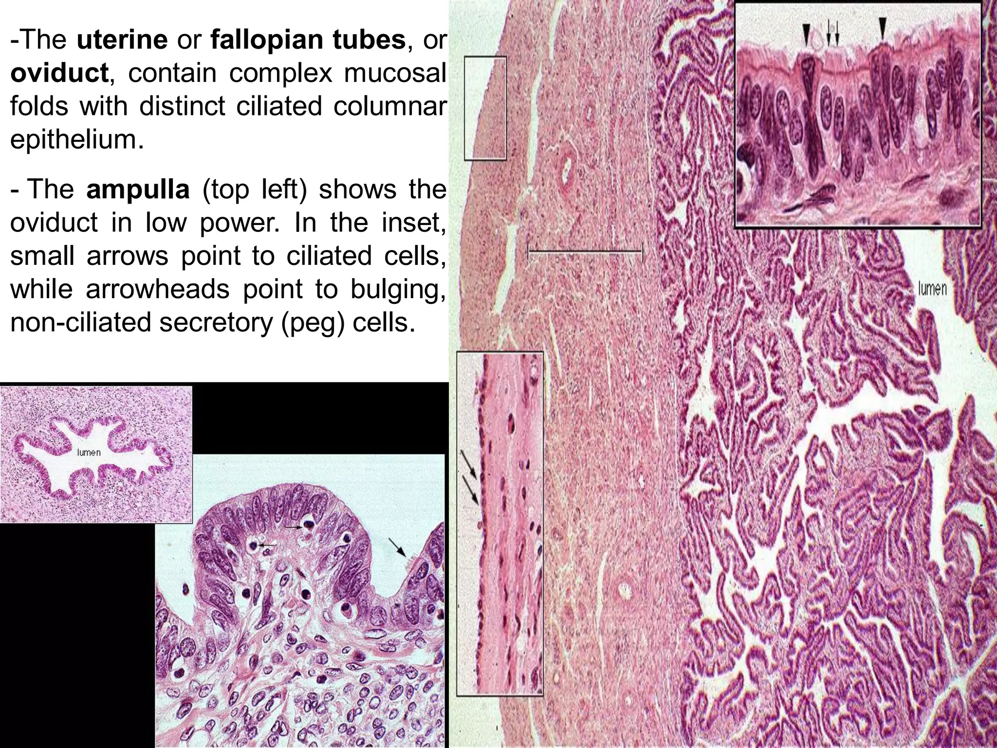-The uterine or fallopian tubes, or
oviduct, contain complex mucosal
folds with distinct ciliated columnar
epithelium.
- The ampulla (top left) shows the
oviduct in low power. In the inset,
small arrows point to ciliated cells,
while arrowheads point to bulging,
non-ciliated secretory (peg) cells.
 