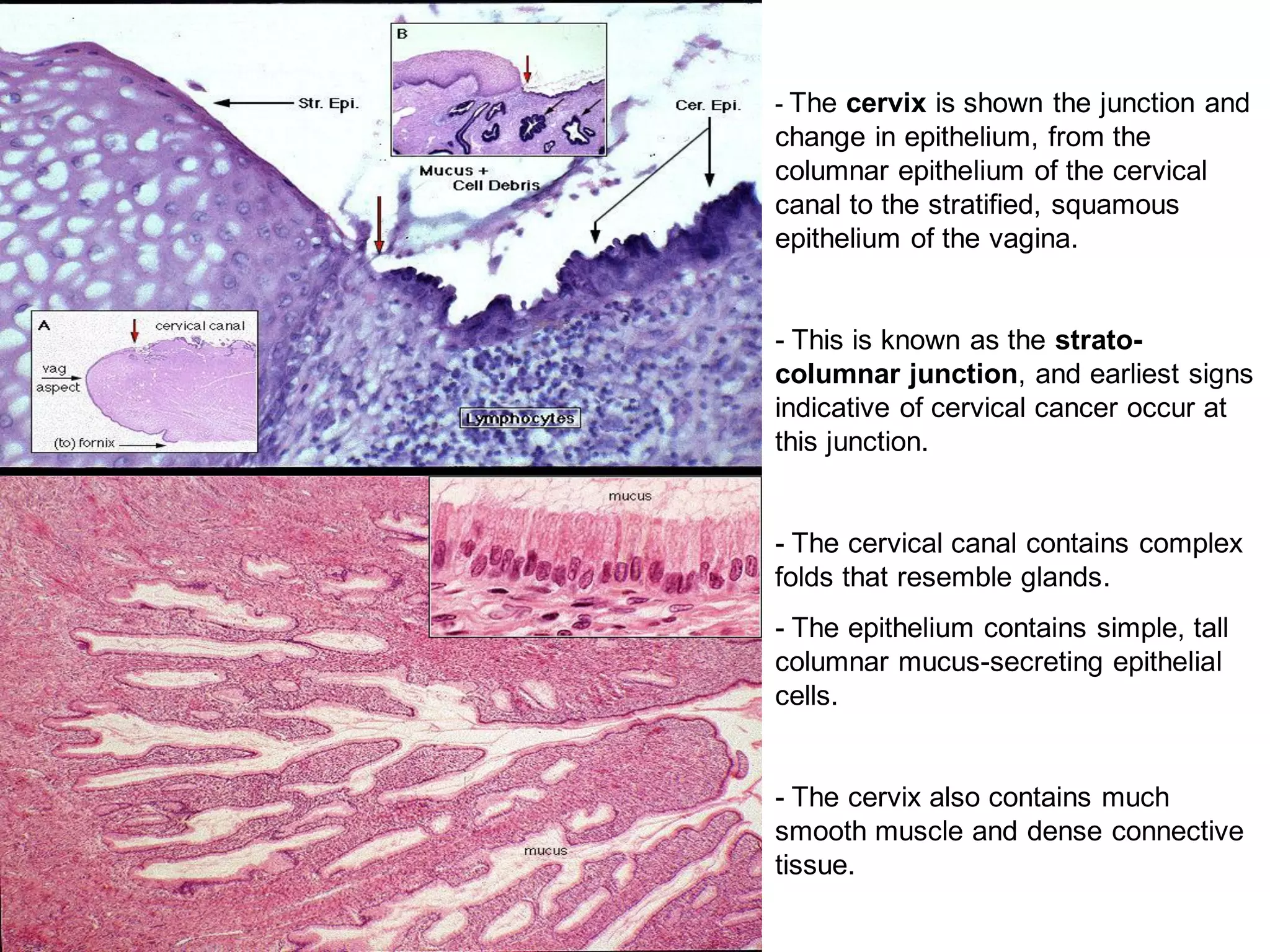 - The cervix is shown the junction and
change in epithelium, from the
columnar epithelium of the cervical
canal to the stratified, squamous
epithelium of the vagina.


- This is known as the strato-
columnar junction, and earliest signs
indicative of cervical cancer occur at
this junction.


- The cervical canal contains complex
folds that resemble glands.
- The epithelium contains simple, tall
columnar mucus-secreting epithelial
cells.


- The cervix also contains much
smooth muscle and dense connective
tissue.
 