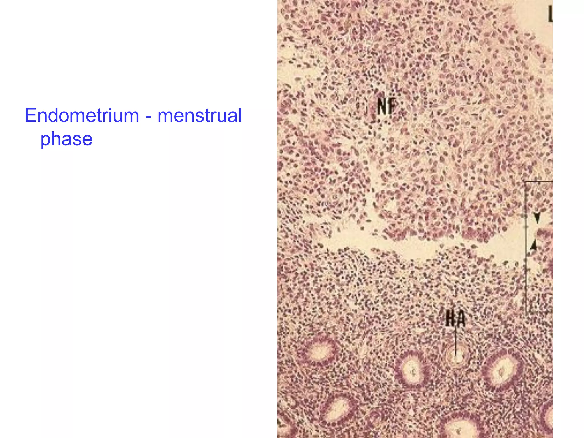 Endometrium - menstrual
 phase
 