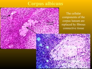 Corpus albicans
The cellular
components of the
corpus luteum are
replaced by fibrous
connective tissue
 