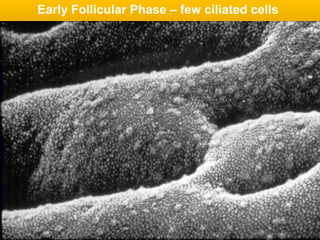 Early Follicular Phase – few ciliated cells
 