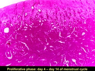 Proliferative phase: day 4 – day 14 of menstrual cycle
 