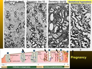 Gestational hyperplasiaProliferative: day 9 Secretory: day 15 Secretory: day19
Pregnancy
 