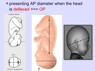 Female bony pelvis and fetal skull for undergraduate | PPT