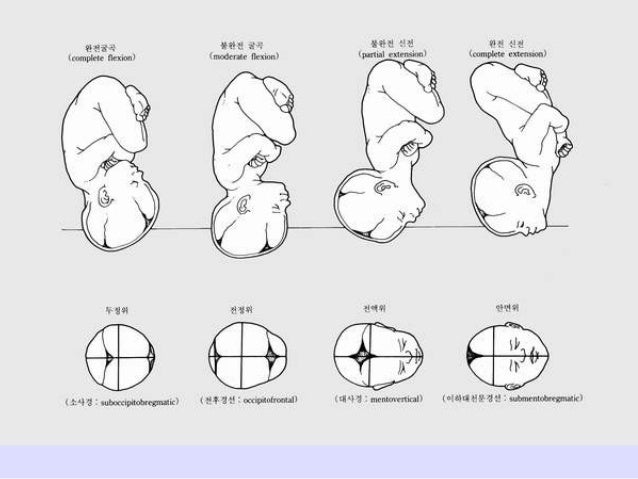 Female bony pelvis and fetal skull for undergraduate