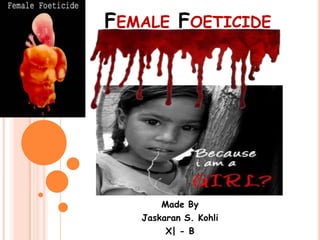 FEMALE FOETICIDE
Made By
Jaskaran S. Kohli
X| - B
 