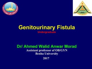 Genitourinary Fistula
Undergraduate
Dr/ Ahmed Walid Anwar Morad
Assistant professor of OB/GYN
Benha University
2017
 