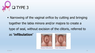 FEMALE GENITAL MUTILATION (FGM).pptx