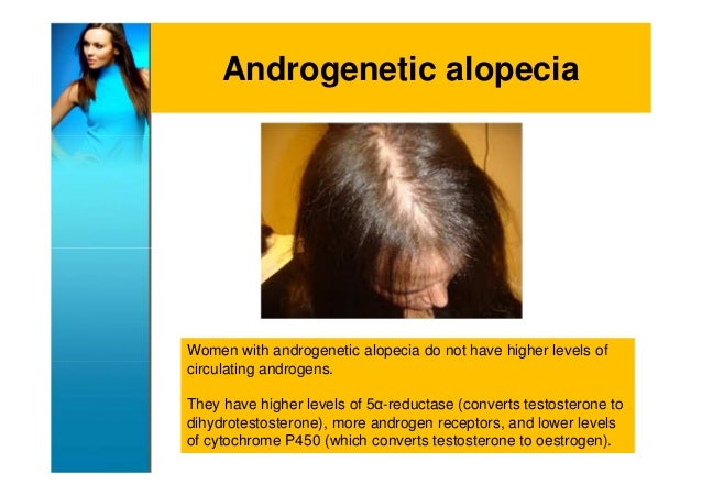 Androgenetic Alopecia Genetic And Rare Diseases Androgenetic Alopecia Genetic And Rare Diseases