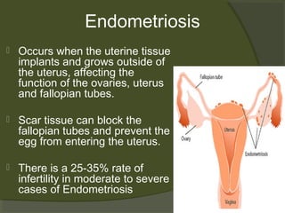 Endometriosis


Occurs when the uterine tissue
implants and grows outside of
the uterus, affecting the
function of the ovaries, uterus
and fallopian tubes.



Scar tissue can block the
fallopian tubes and prevent the
egg from entering the uterus.



There is a 25-35% rate of
infertility in moderate to severe
cases of Endometriosis

 