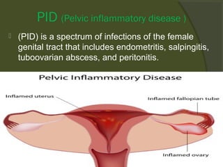 PID (Pelvic inflammatory disease )


(PID) is a spectrum of infections of the female
genital tract that includes endometritis, salpingitis,
tuboovarian abscess, and peritonitis.

 