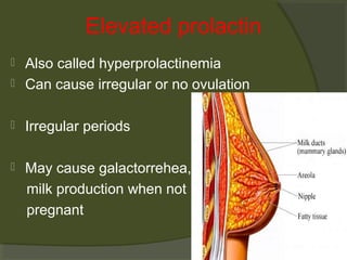 Elevated prolactin


Also called hyperprolactinemia
Can cause irregular or no ovulation



Irregular periods



May cause galactorrehea,
milk production when not
pregnant



 