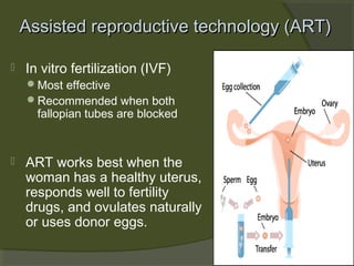 Assisted reproductive technology (ART)


In vitro fertilization (IVF)

Most effective
Recommended when both

fallopian tubes are blocked



ART works best when the
woman has a healthy uterus,
responds well to fertility
drugs, and ovulates naturally
or uses donor eggs.

 