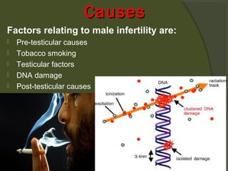 Causes
Factors relating to male infertility are:






Pre-testicular causes
Tobacco smoking
Testicular factors
DNA damage
Post-testicular causes

 