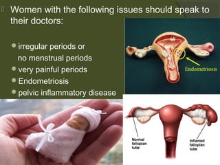 

Women with the following issues should speak to
their doctors:
irregular periods or

no menstrual periods
very painful periods
Endometriosis
pelvic inflammatory disease
more than one miscarriage

 
