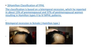 Female Pattern Hair Loss | Chapter 20 | Practical Guide To Hair ...