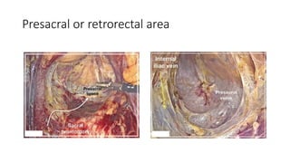 FEMALE PELVIC ANATOMY THROUGH A LAPAROSCOPIC EYE GM7.0 (1).pptx