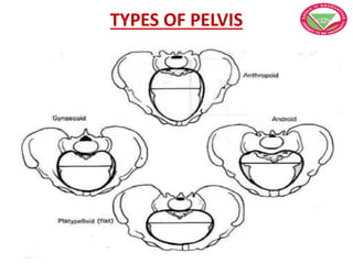 TYPES OF PELVIS
 