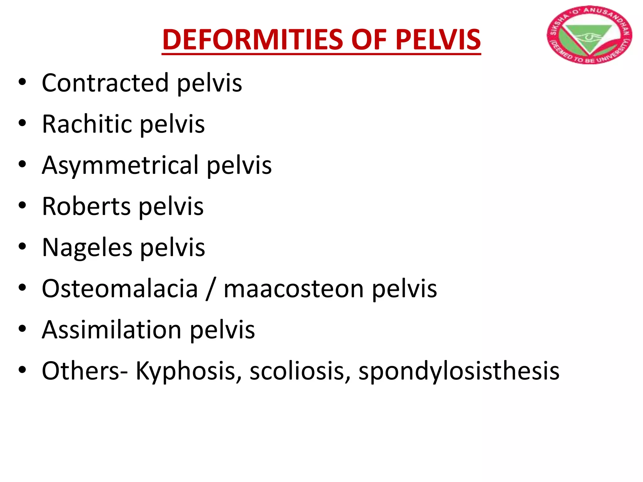 DEFORMITIES OF PELVIS
• Contracted pelvis
• Rachitic pelvis
• Asymmetrical pelvis
• Roberts pelvis
• Nageles pelvis
• Osteomalacia / maacosteon pelvis
• Assimilation pelvis
• Others- Kyphosis, scoliosis, spondylosisthesis
 