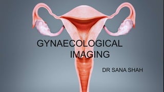 GYNAECOLOGICAL
IMAGING
DR SANA SHAH
 