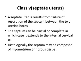 Imperforate hymen
• The vaginal plate develops near the junction
of the lower part of the vagina and vestibule
• Canalizat...