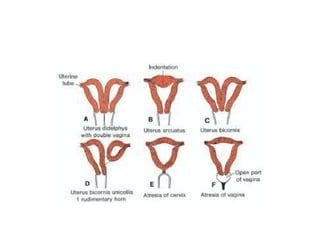Cervix:
Endocervix:
– Is the cavity of cervix ,connect the external os with
internal os
– Is lined by tall columnar epithe...
