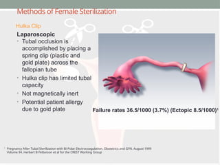 Methods of Female Sterilization
Laparoscopic
• Tubal occlusion is
accomplished by placing a
spring clip (plastic and
gold plate) across the
fallopian tube
• Hulka clip has limited tubal
capacity
• Not magnetically inert
• Potential patient allergy
due to gold plate
1
Pregnancy After Tubal Sterilization with Bi-Polar Electrocoagulation. Obstetrics and GYN. August 1999
Volume 94. Herbert B Petterson et al for the CREST Working Group
Failure rates 36.5/1000 (3.7%) (Ectopic 8.5/1000)1
Hulka Clip
 