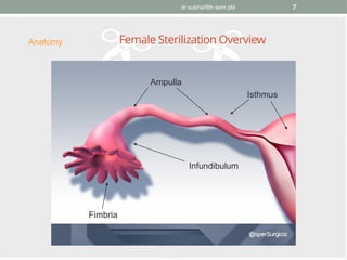 dr subha/8th sem pbl 7
Female Sterilization Overview
Anatomy
Ampulla
Isthmus
Fimbria
Infundibulum
 