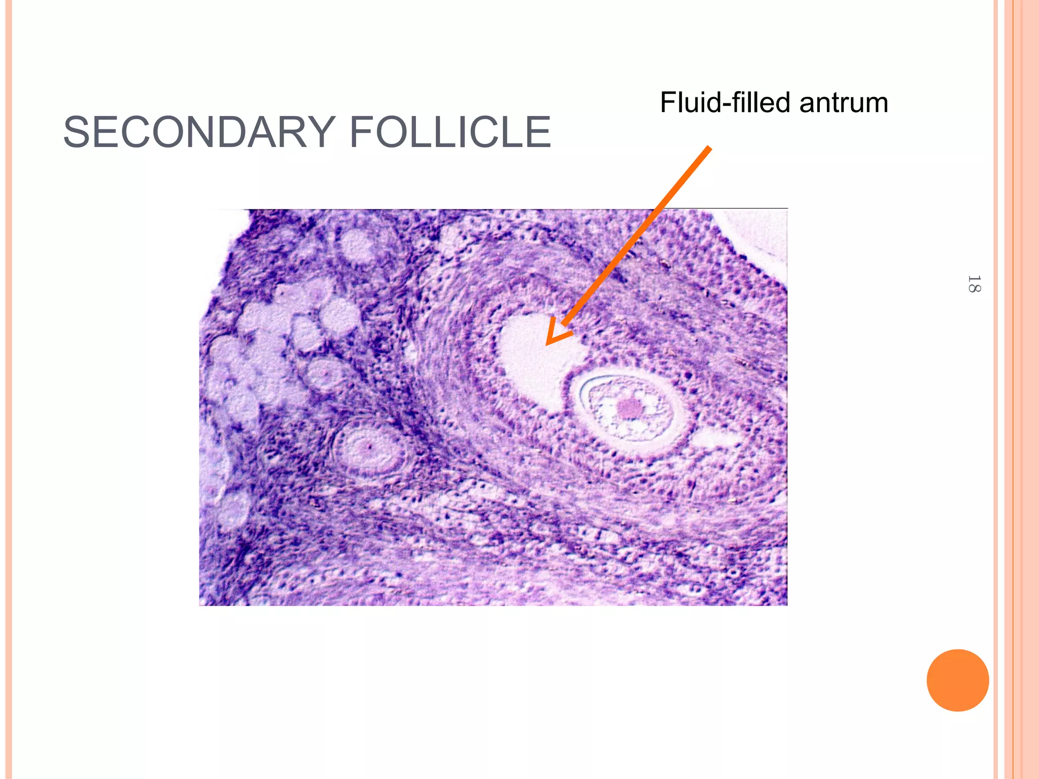 18
SECONDARY FOLLICLE
Fluid-filled antrum
 