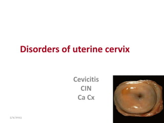 Disorders of uterine cervix
Cevicitis
CIN
Ca Cx
5/9/2023 14
 