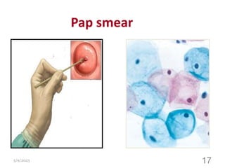 Pap smear
5/9/2023
Dr
Mohammed
Fathalla
17
 