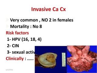 Invasive Ca Cx
Very common , NO 2 in females
Mortality : No 8
Risk factors
1- HPV (16, 18, 4)
2- CIN
3- sexual activity , parity , smoking ,...
Clinically : .....
5/9/2023 Dr Mohammed Fathalla 19
 