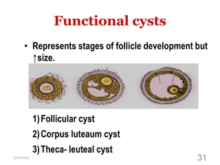 Functional cysts
• Represents stages of follicle development but
↑size.
5/9/2023 31
1)Follicular cyst
2)Corpus luteaum cyst
3)Theca- leuteal cyst
 