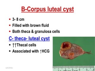 B-Corpus luteal cyst
 3- 8 cm
 Filled with brown fluid
 Both theca & granulosa cells
C- theca- luteal cyst
 ↑↑Thecal cells
 Associated with ↑HCG
5/9/2023 33
 
