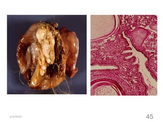 5/9/2023
Dr
Mohammed
Fathalla
45
 