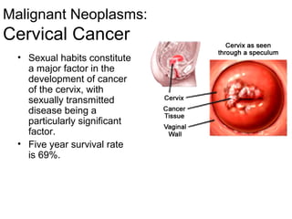 Malignant Neoplasms:
Cervical Cancer
  • Sexual habits constitute
    a major factor in the
    development of cancer
    of the cervix, with
    sexually transmitted
    disease being a
    particularly significant
    factor.
  • Five year survival rate
    is 69%.
 