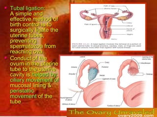 Female reproductive system | PPSX