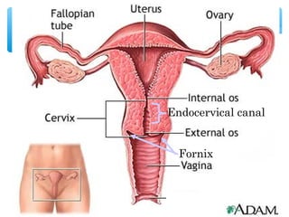 18 
Endocervical canal 
Fornix 
 