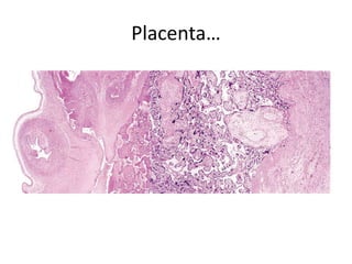 Placenta…
 
